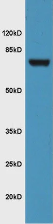 Western blot - Anti-FZD3 antibody (AB217032)