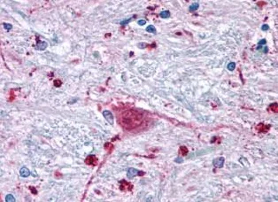 Immunohistochemistry (Formalin/PFA-fixed paraffin-embedded sections) - Anti-FZD3 antibody - N-terminal (AB188974)