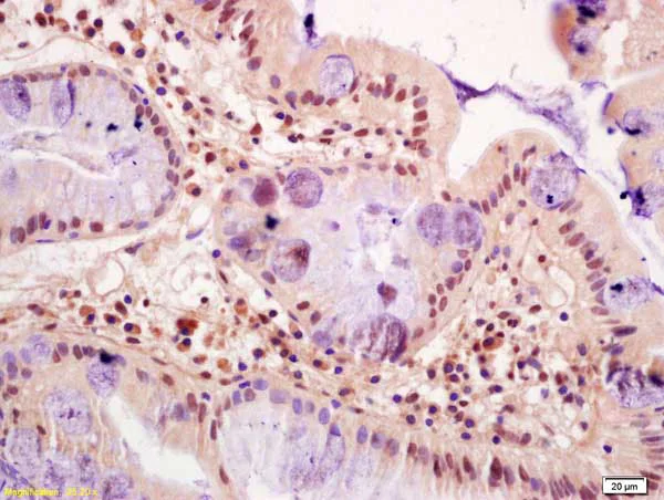 Immunohistochemistry (Formalin/PFA-fixed paraffin-embedded sections) - Anti-FZR1 antibody (AB217038)