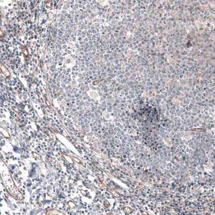 Immunohistochemistry (Formalin/PFA-fixed paraffin-embedded sections) - Anti-G-6-Pase antibody [CL5818] (AB243319)
