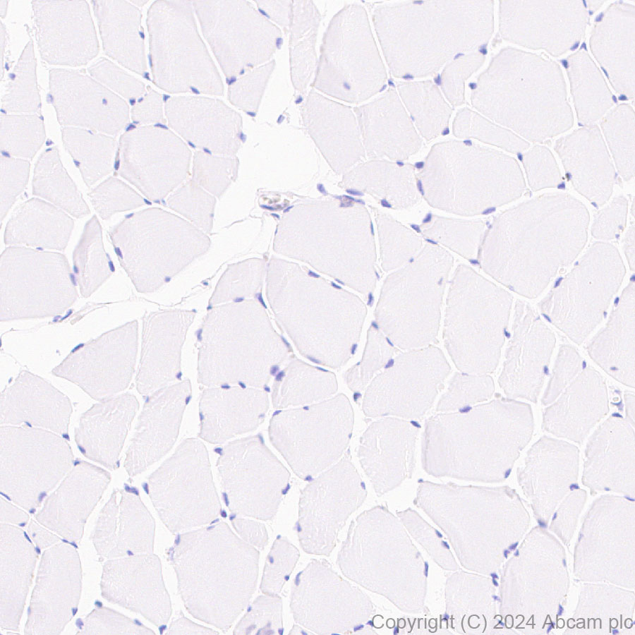 Immunohistochemistry (Formalin/PFA-fixed paraffin-embedded sections) - Anti-G-6-Pase antibody [EPR28793-52] (AB319053)