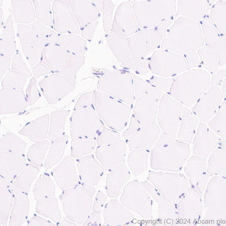 Immunohistochemistry (Formalin/PFA-fixed paraffin-embedded sections) - Anti-G-6-Pase antibody [EPR28793-52] (AB319053)