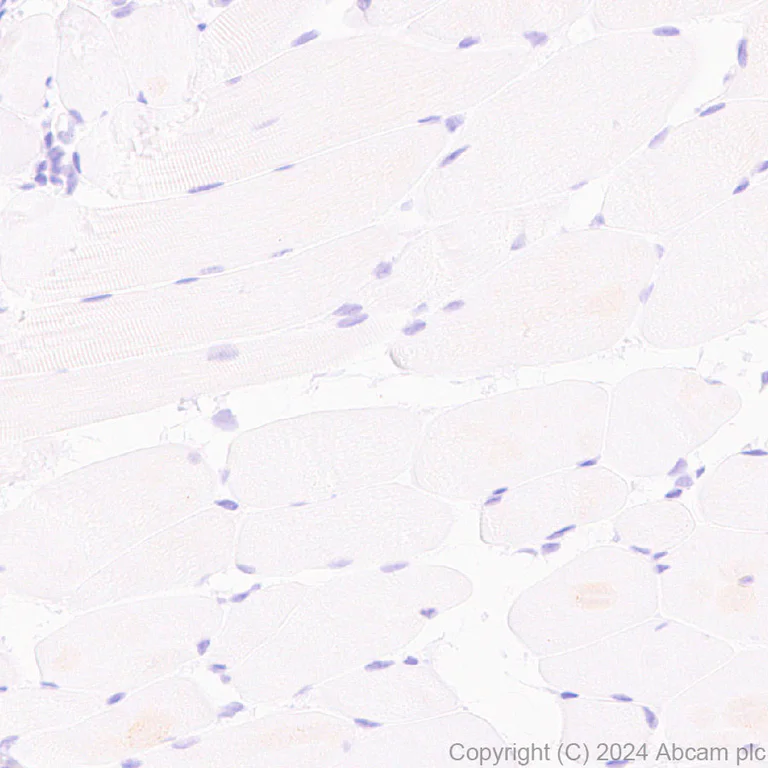 Immunohistochemistry (Formalin/PFA-fixed paraffin-embedded sections) - Anti-G-6-Pase antibody [EPR28793-52] (AB319053)