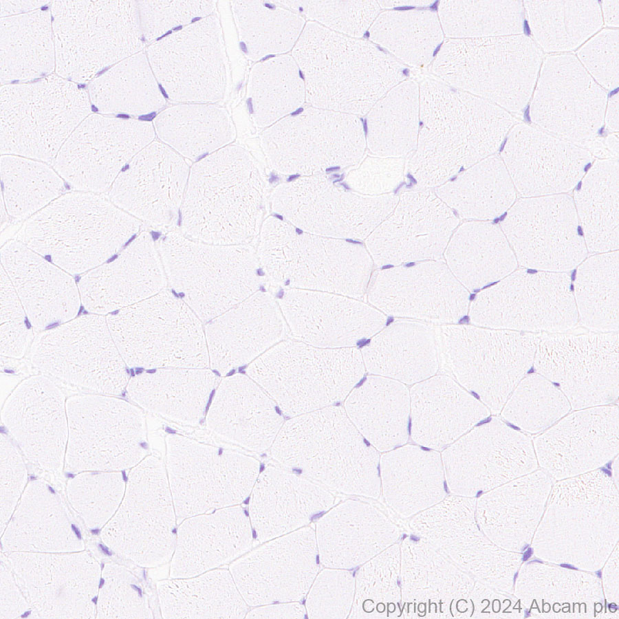 Immunohistochemistry (Formalin/PFA-fixed paraffin-embedded sections) - Anti-G-6-Pase antibody [EPR28793-52] - BSA and Azide free (ab319054), expandable thumbnail