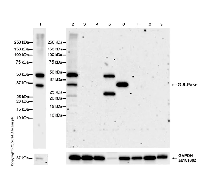 Western blot - Anti-G-6-Pase antibody [EPR28793-52] - BSA and Azide free (AB319054)