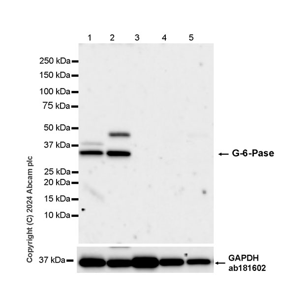 Western blot - Anti-G-6-Pase antibody [EPR28793-52] - BSA and Azide free (ab319054), expandable thumbnail