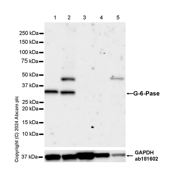 Western blot - Anti-G-6-Pase antibody [EPR28793-52] - BSA and Azide free (AB319054)