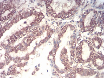 Immunohistochemistry (Formalin/PFA-fixed paraffin-embedded sections) - Anti-G-CSF antibody [7E4F7] (AB204989)