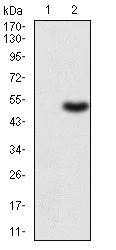 Western blot - Anti-G-CSF antibody [7E4F7] (AB204989)
