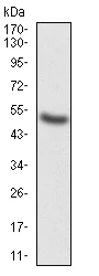 Western blot - Anti-G-CSF antibody [7E4F7] (AB204989)