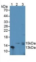 Western blot - Anti-G-CSF antibody (AB231277), expandable thumbnail