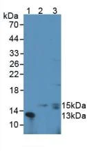 Western blot - Anti-G-CSF antibody (AB231277)