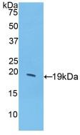 Western blot - Anti-G-CSF antibody (AB231277), expandable thumbnail