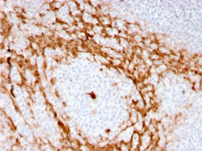 Immunohistochemistry (Formalin/PFA-fixed paraffin-embedded sections) - Anti-G-CSF antibody [CSF3/3166R] (AB270267)