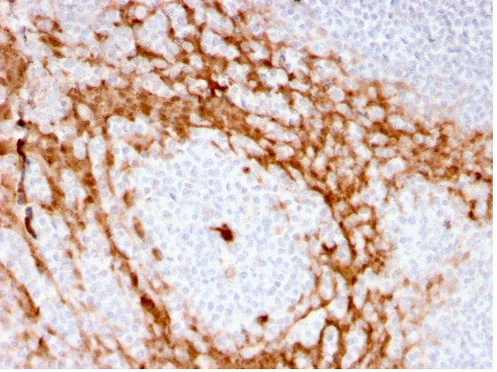 Immunohistochemistry (Formalin/PFA-fixed paraffin-embedded sections) - Anti-G-CSF antibody [CSF3/3166R] - BSA and Azide free (AB270298), expandable thumbnail