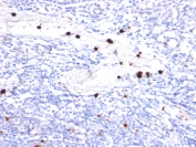 Immunohistochemistry (Formalin/PFA-fixed paraffin-embedded sections) - Anti-G-CSF antibody [CSF3/900] (AB216607), expandable thumbnail