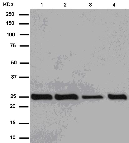 Western blot - Anti-G-CSF antibody [EPR3203(N)(B)] (AB181053), expandable thumbnail
