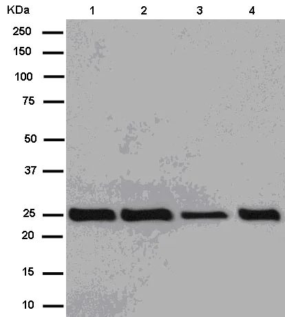 Western blot - Anti-G-CSF antibody [EPR3203(N)(B)] (AB181053)