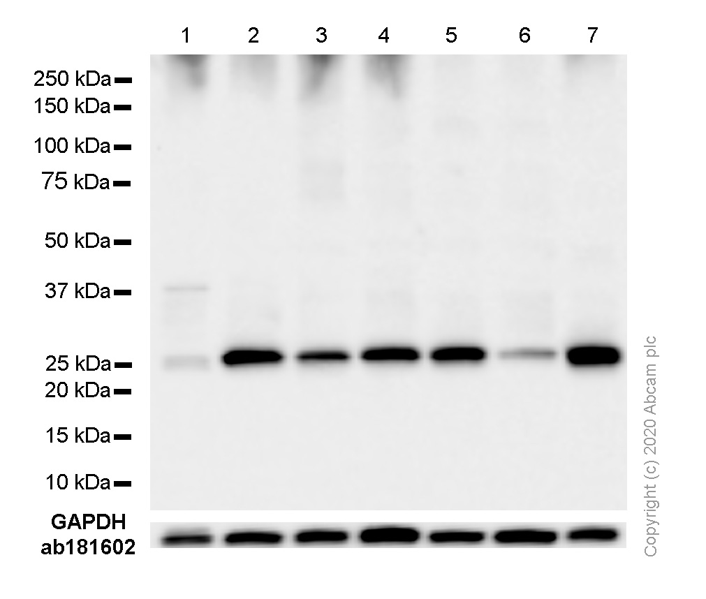 Western blot - Anti-G-CSF antibody [EPR3203(N)(B)] - BSA and Azide free (AB236157), expandable thumbnail