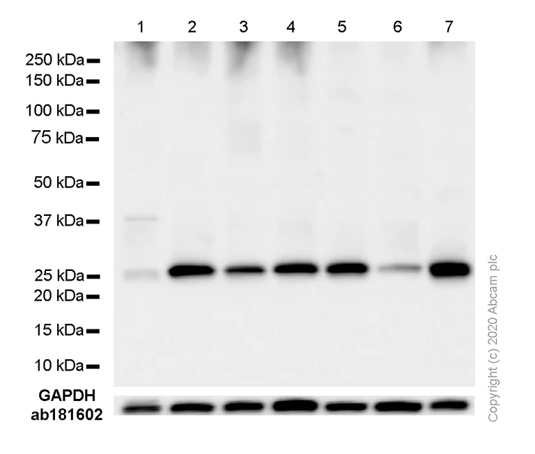 Western blot - Anti-G-CSF antibody [EPR3203(N)(B)] - BSA and Azide free (AB236157)