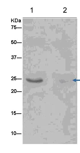 Immunoprecipitation - Anti-G-CSF antibody [EPR3203(N)(B)] - Low endotoxin, Azide free (AB246705)
