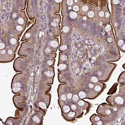 Immunohistochemistry (Formalin/PFA-fixed paraffin-embedded sections) - Anti-G gamma12 antibody (AB204757)