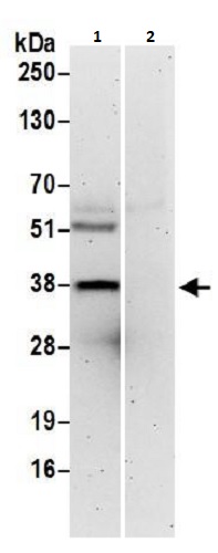 Immunoprecipitation - Anti-G protein beta subunit like/GBL antibody (AB264140)