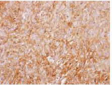 Immunohistochemistry (Formalin/PFA-fixed paraffin-embedded sections) - Anti-G-protein coupled receptor 30 antibody (AB137479), expandable thumbnail