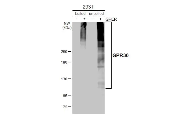 Western blot - Anti-G-protein coupled receptor 30 antibody (AB137479)