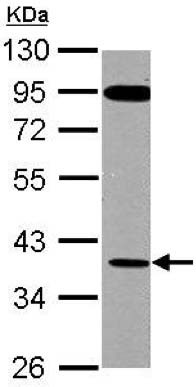 Western blot - Anti-G-protein coupled receptor 30 antibody (AB137479), expandable thumbnail