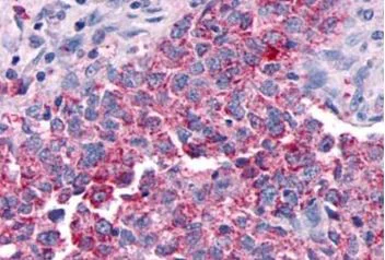 Immunohistochemistry (Formalin/PFA-fixed paraffin-embedded sections) - Anti-G-protein coupled receptor 30 antibody (AB188607)