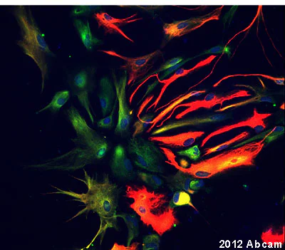 Immunocytochemistry - Anti-G-protein coupled receptor 30 antibody (AB39742)