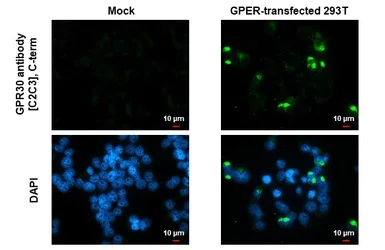 Immunocytochemistry/ Immunofluorescence - Anti-G-protein coupled receptor 30 antibody - C-terminal (AB154069)