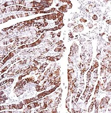 Immunohistochemistry (Formalin/PFA-fixed paraffin-embedded sections) - Anti-G-protein coupled receptor 30 antibody - C-terminal (AB154069)