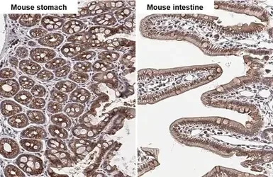 Immunohistochemistry (Formalin/PFA-fixed paraffin-embedded sections) - Anti-G-protein coupled receptor 30 antibody - C-terminal (AB154069)