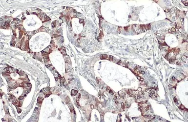 Immunohistochemistry (Formalin/PFA-fixed paraffin-embedded sections) - Anti-G-protein coupled receptor 30 antibody - C-terminal (AB154069)