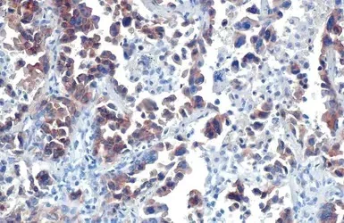 Immunohistochemistry (Formalin/PFA-fixed paraffin-embedded sections) - Anti-G-protein coupled receptor 30 antibody - C-terminal (AB154069)