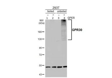 Western blot - Anti-G-protein coupled receptor 30 antibody - C-terminal (AB154069)