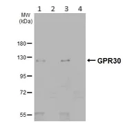 Western blot - Anti-G-protein coupled receptor 30 antibody - C-terminal (AB154069)