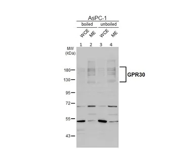 Western blot - Anti-G-protein coupled receptor 30 antibody - C-terminal (AB154069)