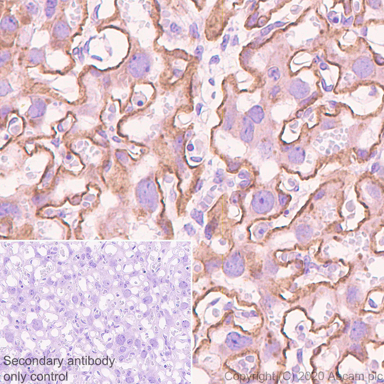 Immunohistochemistry (Formalin/PFA-fixed paraffin-embedded sections) - Anti-G-protein coupled receptor 30 antibody [EPR23701-79] (AB260033)