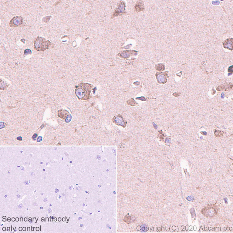 Immunohistochemistry (Formalin/PFA-fixed paraffin-embedded sections) - Anti-G-protein coupled receptor 30 antibody [EPR23701-79] (AB260033)