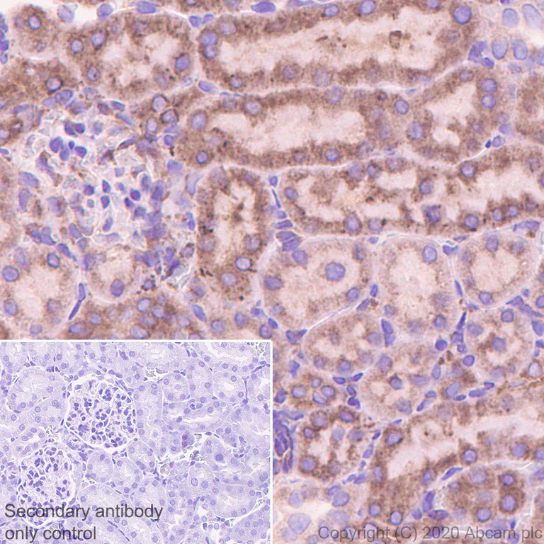 Immunohistochemistry (Formalin/PFA-fixed paraffin-embedded sections) - Anti-G-protein coupled receptor 30 antibody [EPR23701-79] (AB260033)