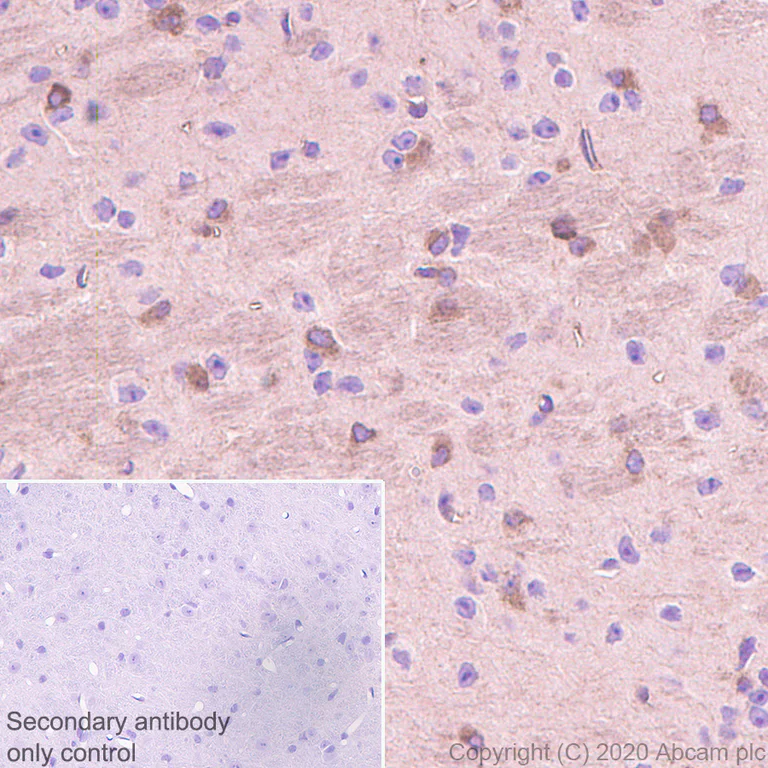 Immunohistochemistry (Formalin/PFA-fixed paraffin-embedded sections) - Anti-G-protein coupled receptor 30 antibody [EPR23701-79] - BSA and Azide free (AB275397)