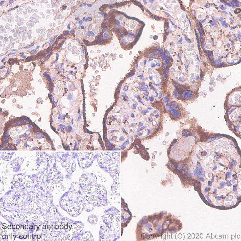 Immunohistochemistry (Formalin/PFA-fixed paraffin-embedded sections) - Anti-G-protein coupled receptor 30 antibody [EPR23701-79] - BSA and Azide free (AB275397)