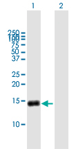 Western blot - Anti-G0/G1switch 2/G0S2 antibody (AB167178)