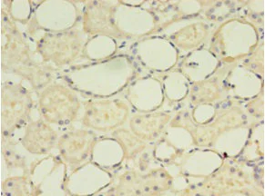 Immunohistochemistry (Formalin/PFA-fixed paraffin-embedded sections) - Anti-G0/G1switch 2/G0S2 antibody (AB236113)