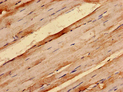 Immunohistochemistry (Formalin/PFA-fixed paraffin-embedded sections) - Anti-G0/G1switch 2/G0S2 antibody (AB236113)