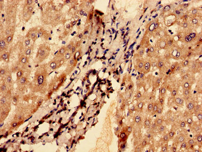 Immunohistochemistry (Formalin/PFA-fixed paraffin-embedded sections) - Anti-G0/G1switch 2/G0S2 antibody (AB236113)