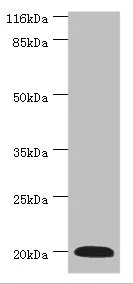 Western blot - Anti-G0/G1switch 2/G0S2 antibody (AB236113)